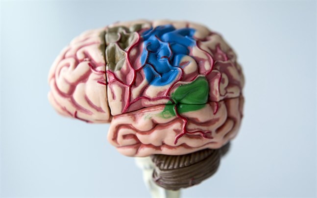 Återkommande tupplurar kan vara ett tidigt tecken på Alzheimers sjukdom, som är en demenssjukdom. Orsaken, tror forskare, är att olika områden i hjärnan som främjar vakenhet dagtid angrips av proteinet tau och dör.