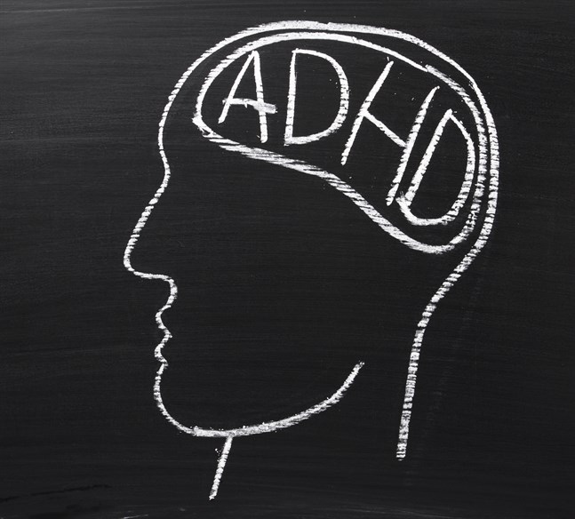 Medicinering med metylfenidat vid adhd tycks påverka hjärnans vita substans.
