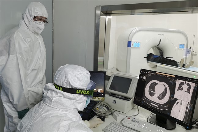 Läkare analyserar röntgenbilder av en patients lungor på ett sjukhus i Wuhan i Hubeiprovinsen.