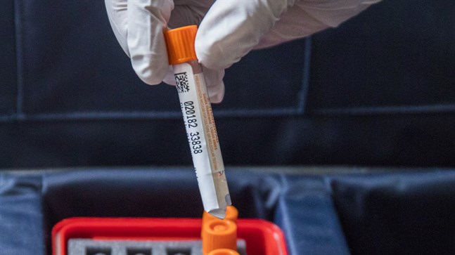 Forskare försöker febrilt testa läkemedel och ta fram vaccin mot det nya coronaviruset. Arkivbild.