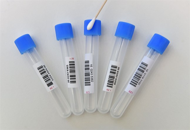 Livsmedelsverkets virologiska laboratorier börjar analysera coronavirusprover i ett samarbete med Institutet för hälsa och välfärd.