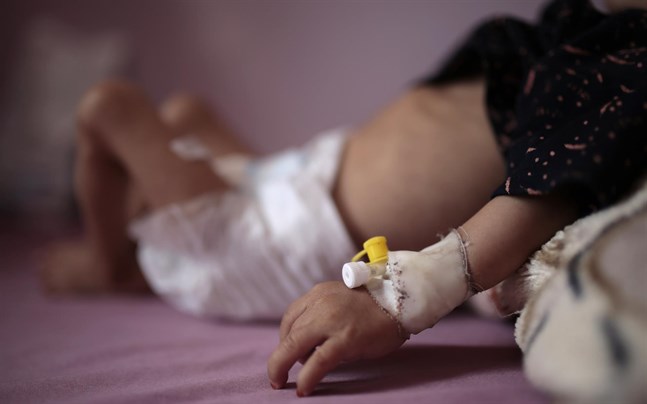 Jemen är i topp på listan över krigshärjade länder som akut behöver humanitärt stöd för att bland annat undvika svält bland barn.