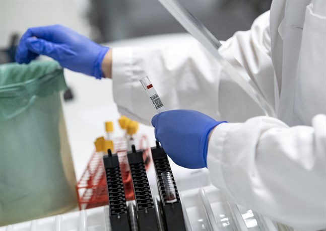 Blodprover görs klara för att analyseras avseende covid-19 antikroppar i ett av laboratorierna på Klinisk mikrobiologi i Lund.