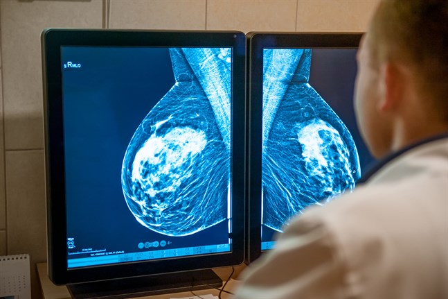 Tumörer i täta bröst framträder med samma vita färg på mammografibilden som tät bröstvävnad. Därför är de svåra att urskilja.